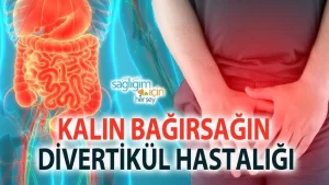 Divertikulit nedir