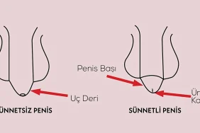 Sunnetin-Faydalari-ve-Zararlari-Bilim-Bu-Konuda-Ne-Diyor