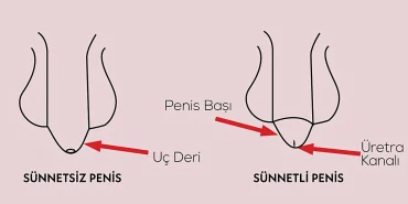 Sunnetin-Faydalari-ve-Zararlari-Bilim-Bu-Konuda-Ne-Diyor