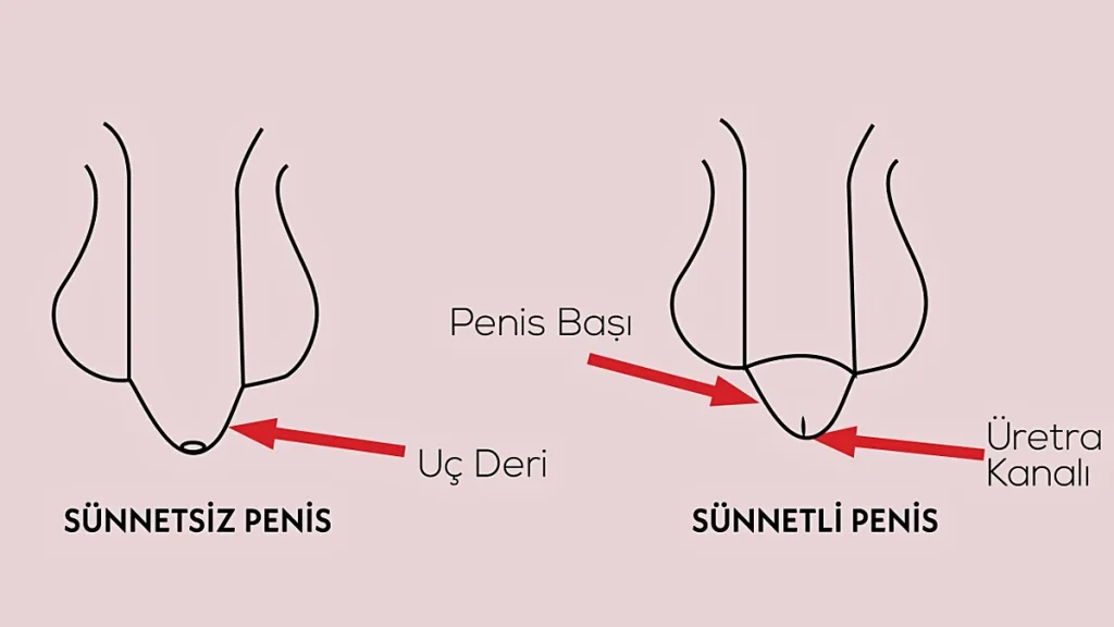 Sünnetin Faydaları ve Zararları Bilim Bu Konuda Ne Diyor
