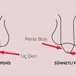 Sünnetin Faydaları ve Zararları Bilim Bu Konuda Ne Diyor